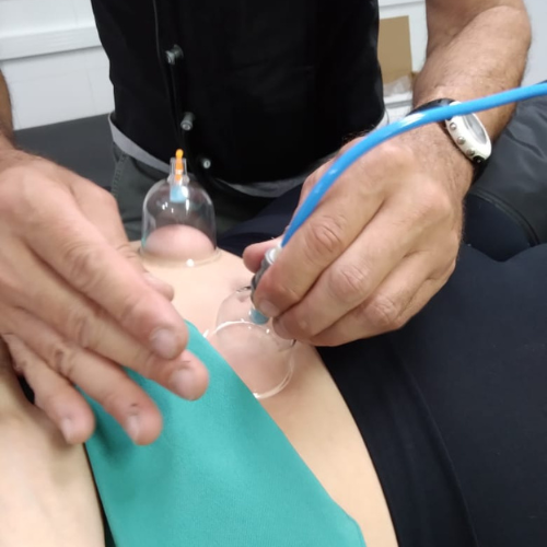 Vacuoterapia
